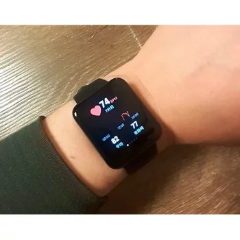 Xiaomi Redmi Watch 2 Lite